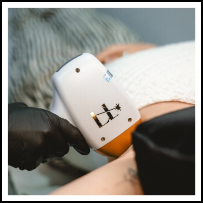 Laser Hair Removal 10